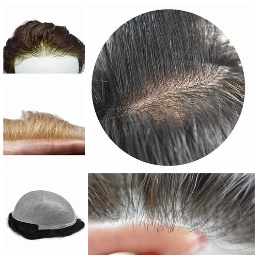 Non-surgical hair replacement system for men hair loss