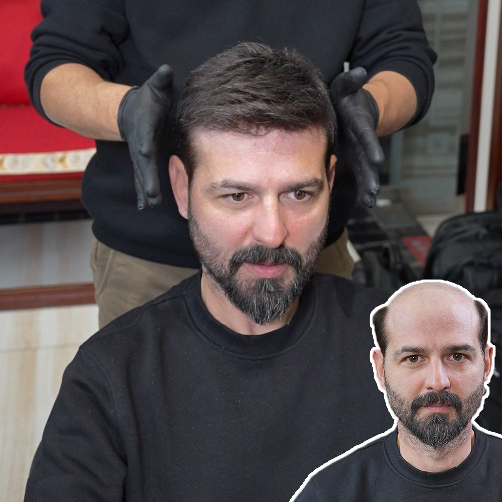 best hair system application
