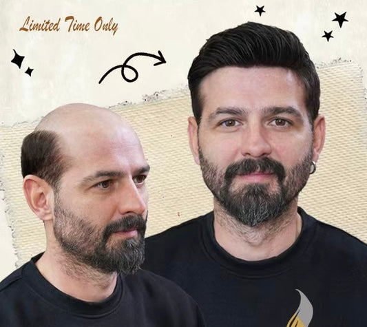 best men's toupee hair loss solution
