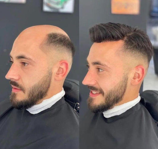 best human hair toupee 2026 ToupeeUnion