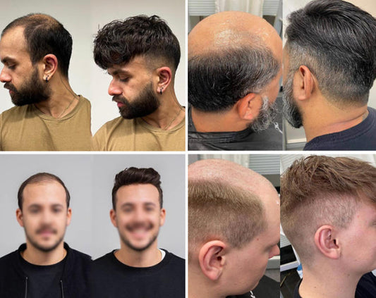 toupee before and after