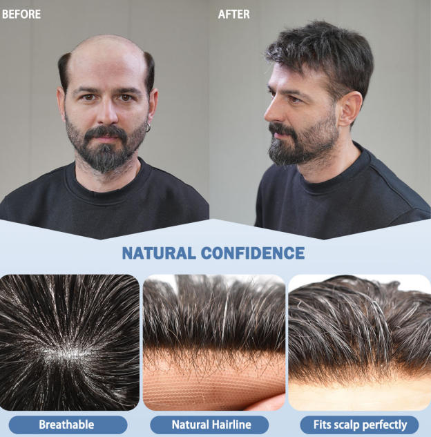 affordable men's hair system US
