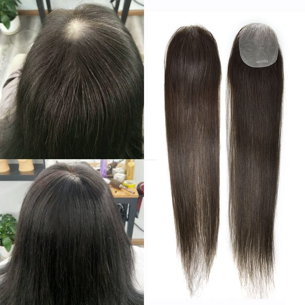 Toupeeunion Thin Skin V-Looped Bald Spot Hair Patch Natural Hair Replacement Unit For Hairline 100% Remy Human Hair Transparent Skin Hair Patch Hair Systems