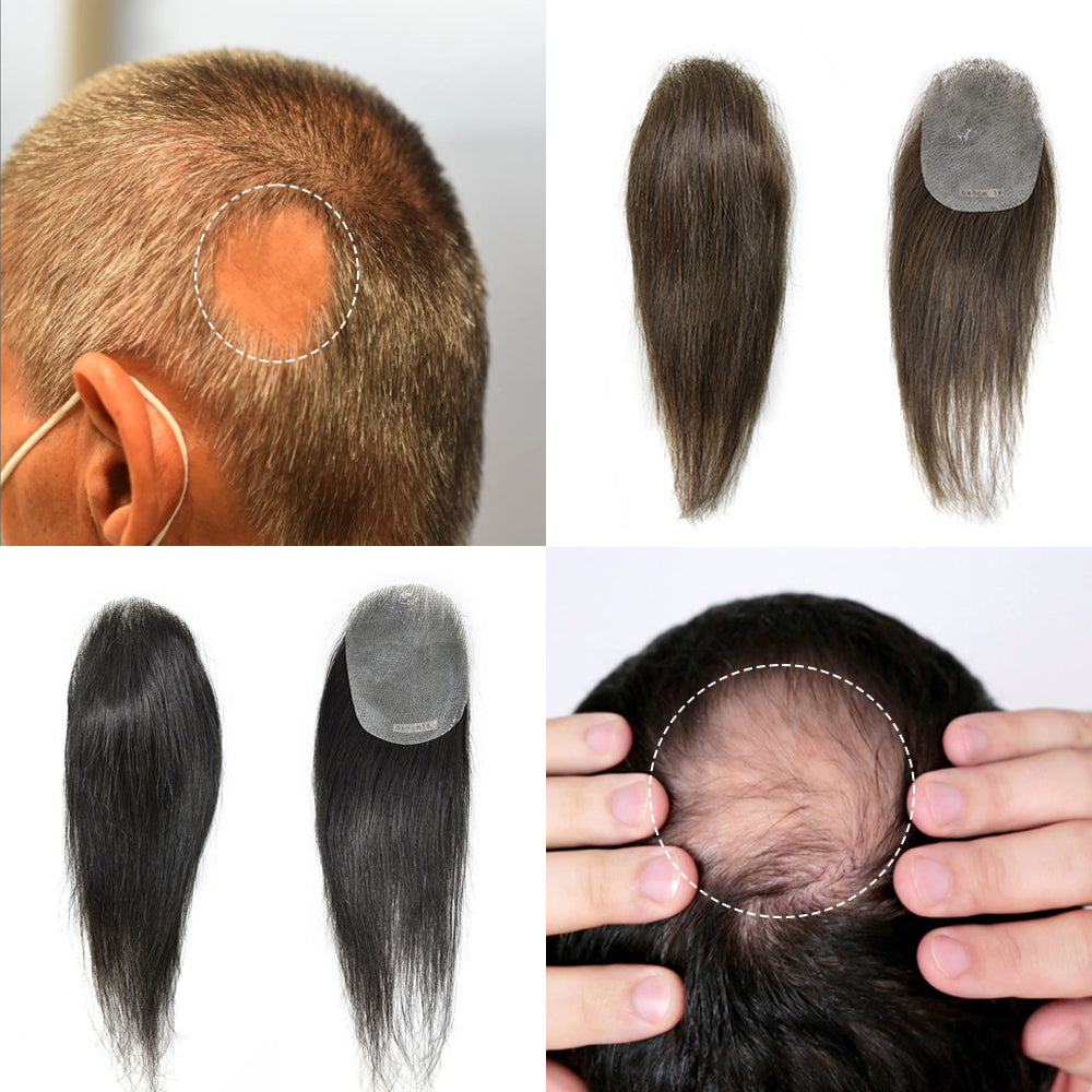 Toupeeunion Thin Skin V-Looped Bald Spot Hair Patch Natural Hair Replacement Unit For Hairline 100% Remy Human Hair Transparent Skin Hair Patch Hair Systems