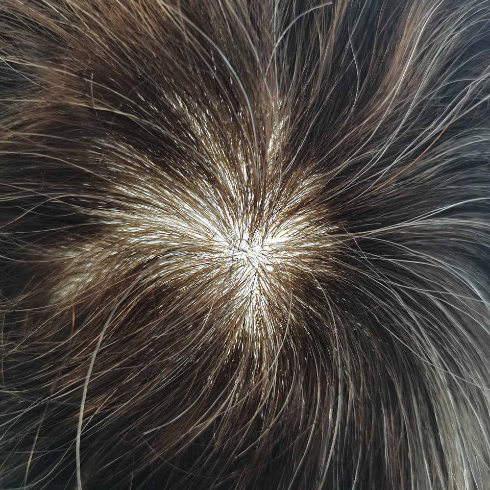Toupeeunion Men's Toupee Remy Human Hair  Poly Injection Hair Replacement System Men Hair Piece